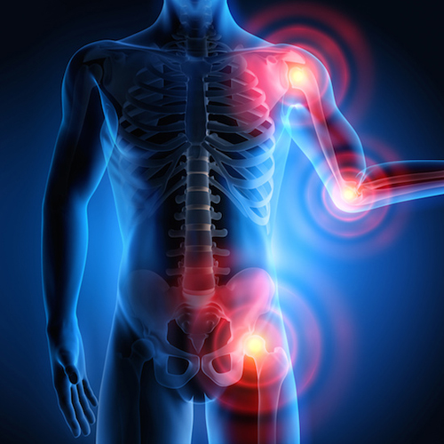 male body displaying inflammation at the joints